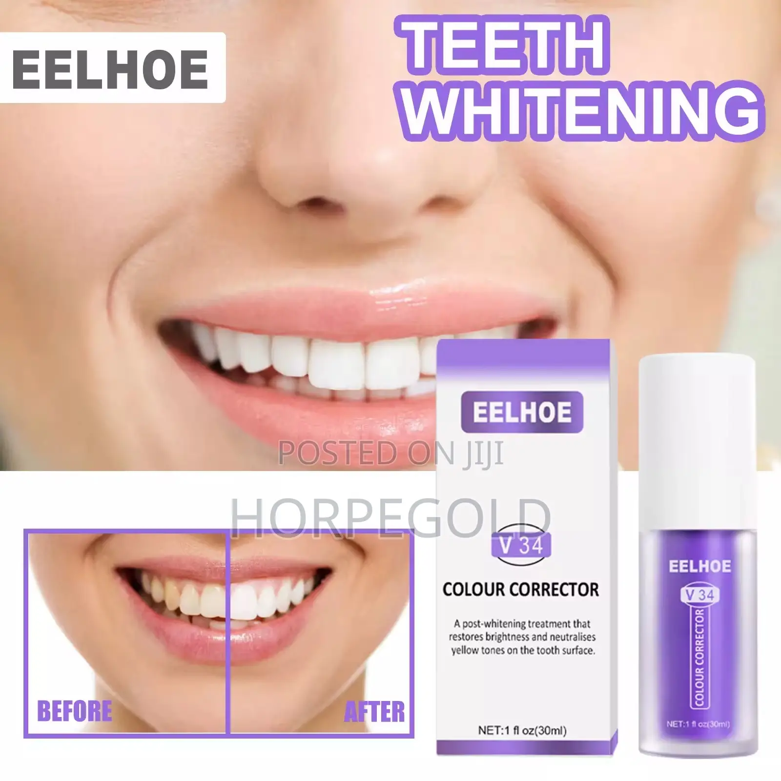 V34 Colour Corrector Teeth Whitening
