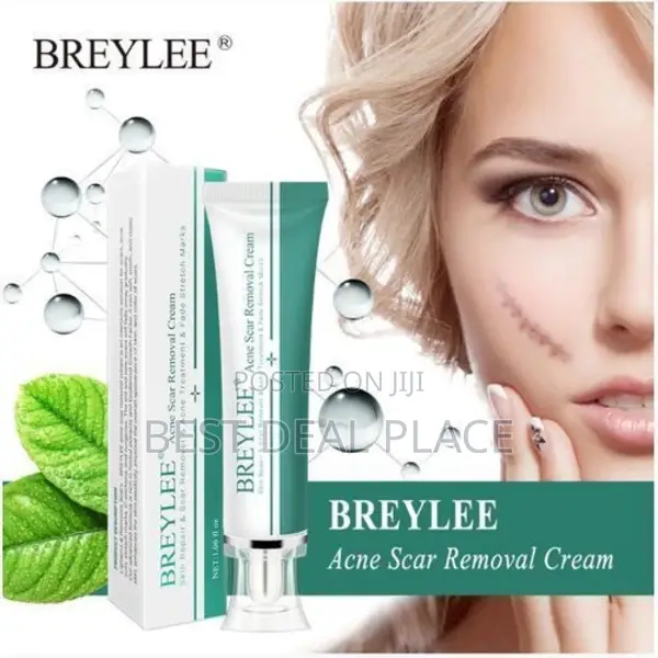 Acne Scar Removal Cream / Acne Treatment /Stretch Mark Cream.
