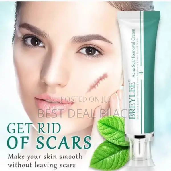Acne Scar Removal Cream / Acne Treatment /Stretch Mark Cream.