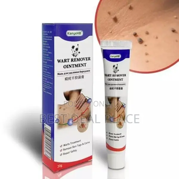 Warts Remover Herbal Treatment Ointment