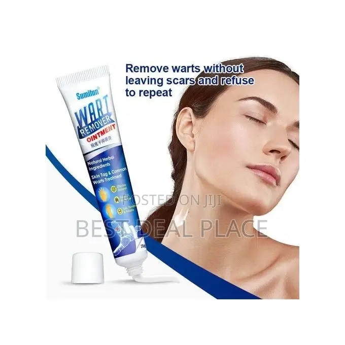 Effective Herbal Wart Removal Ointment Cream