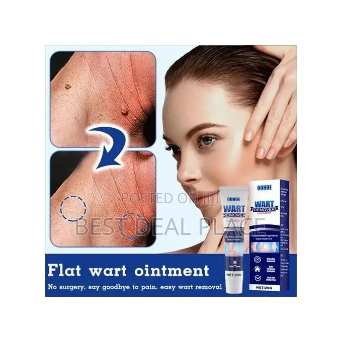 Effective Herbal Wart Removal Ointment Cream