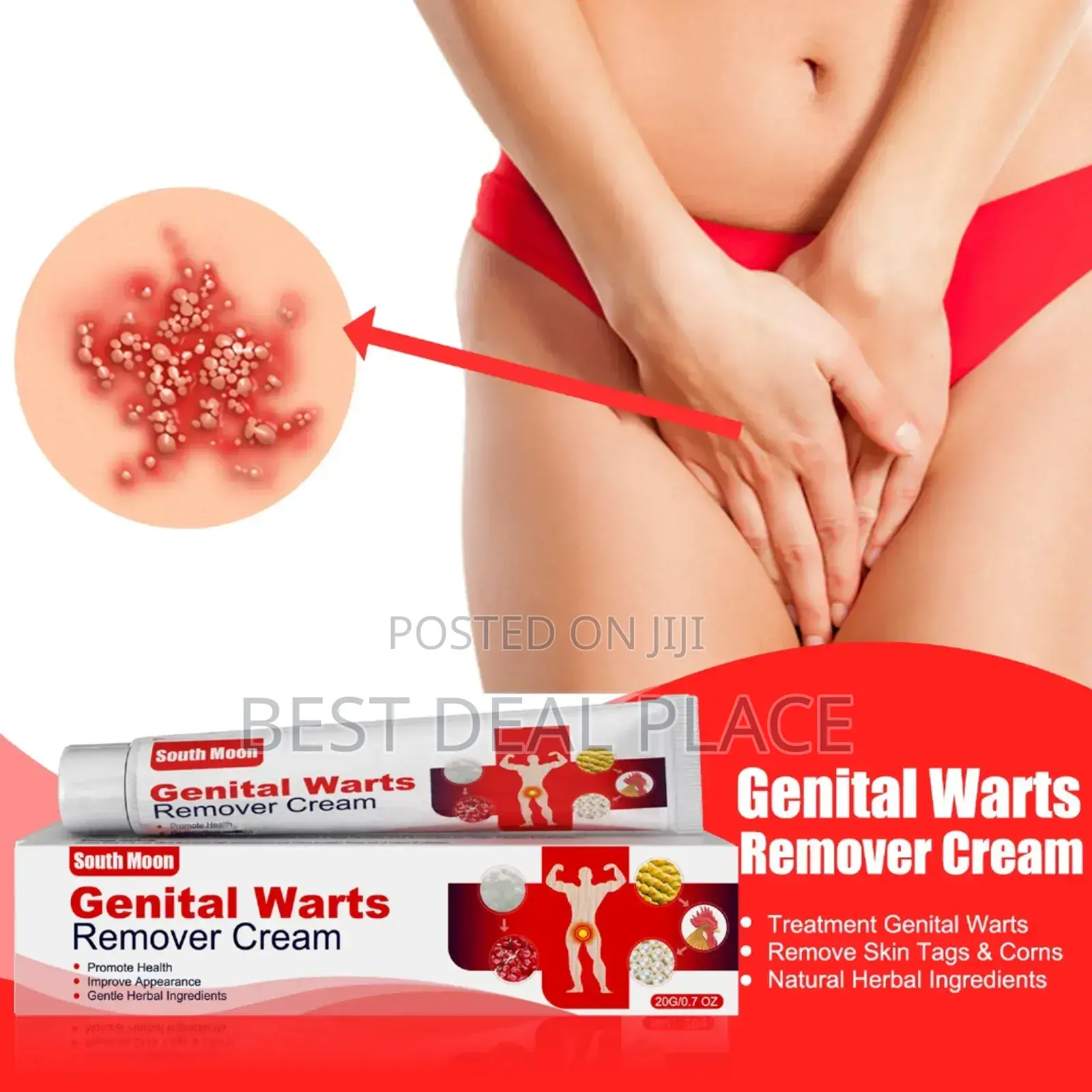 Wart Remover Cream –Fast Effective Skin Care