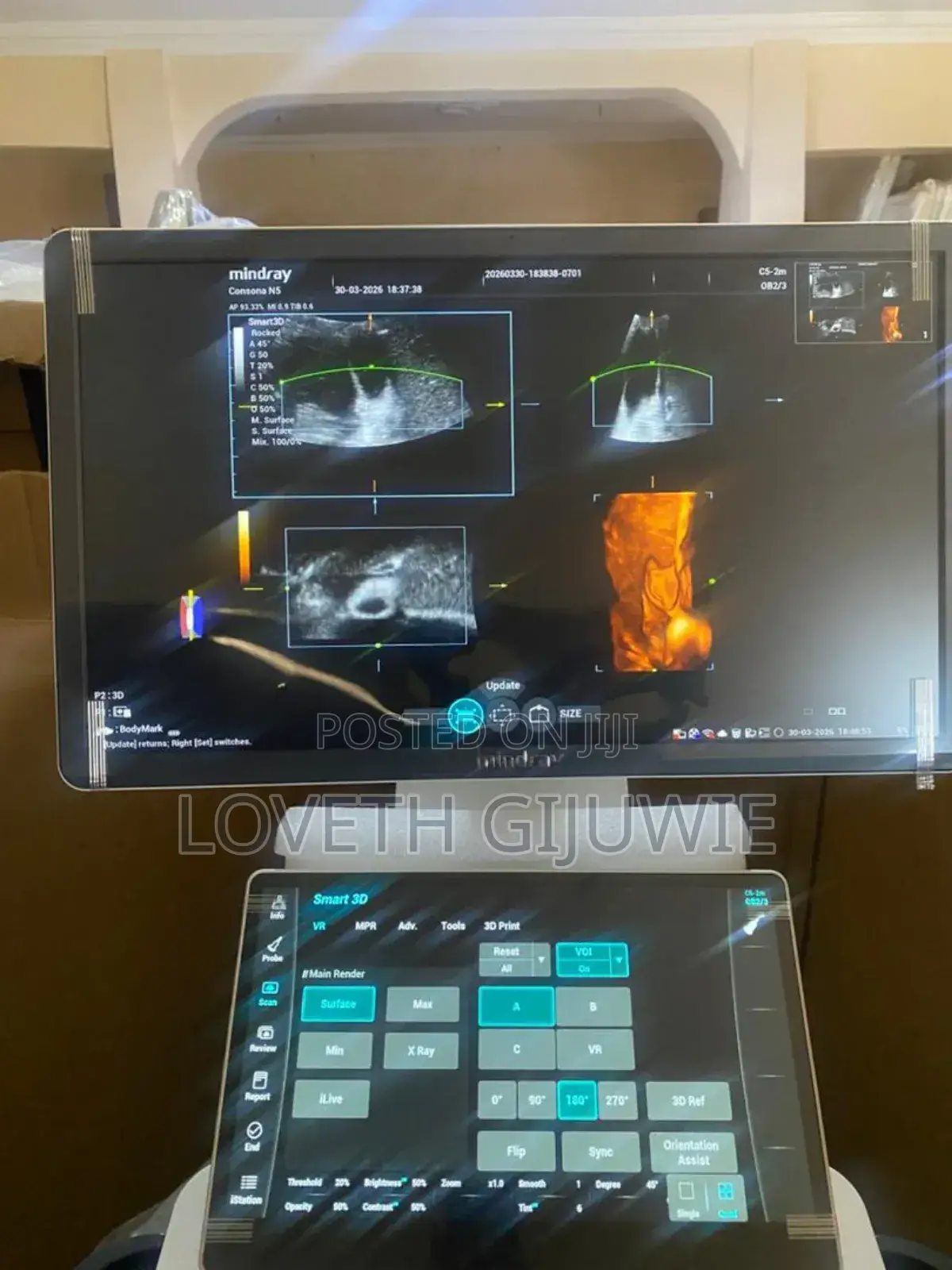 Mindray Consona N5 Ultrasound Machine