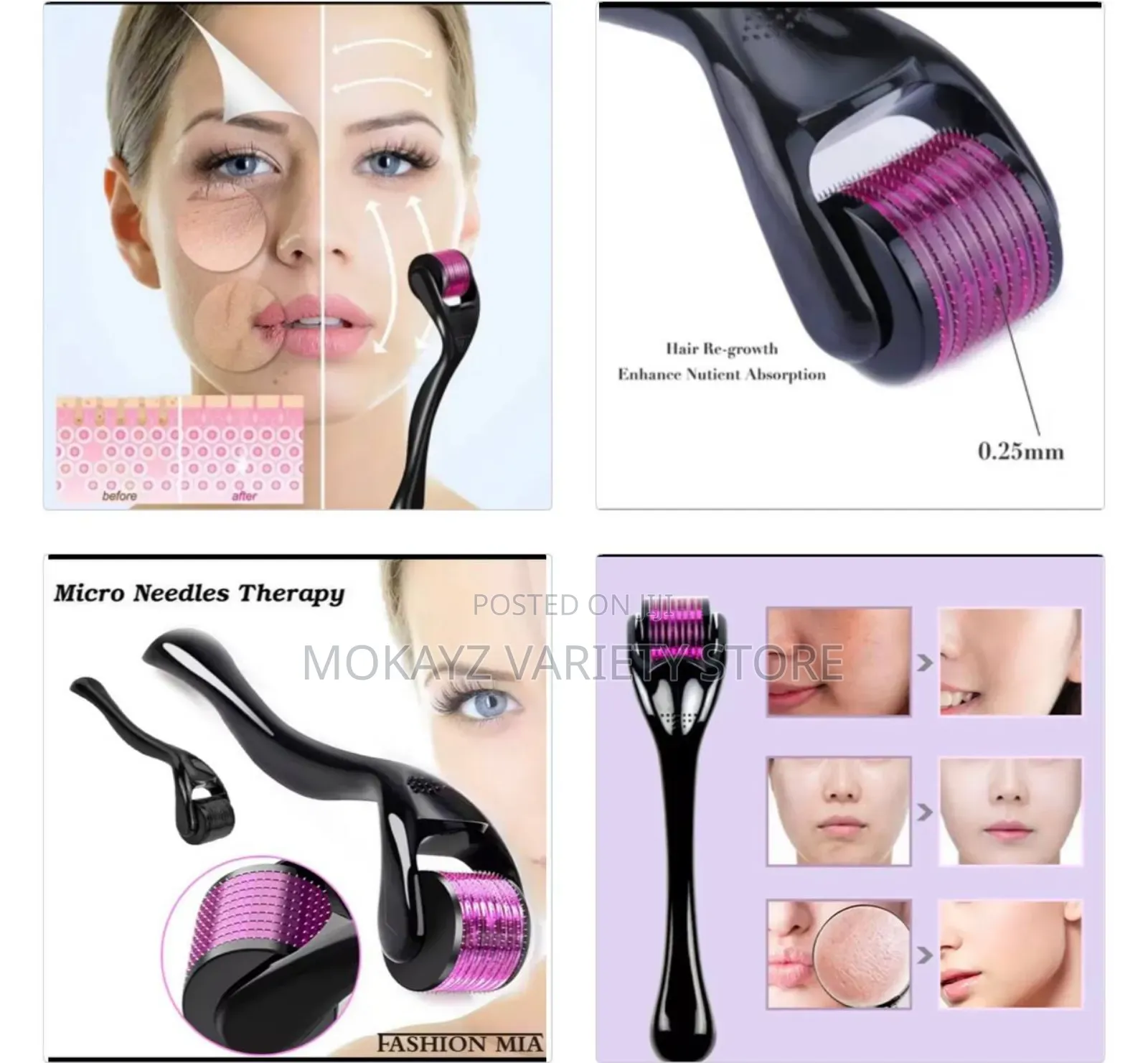 Derma Roller – Professional Microneedling Hair / Skin Care Tool