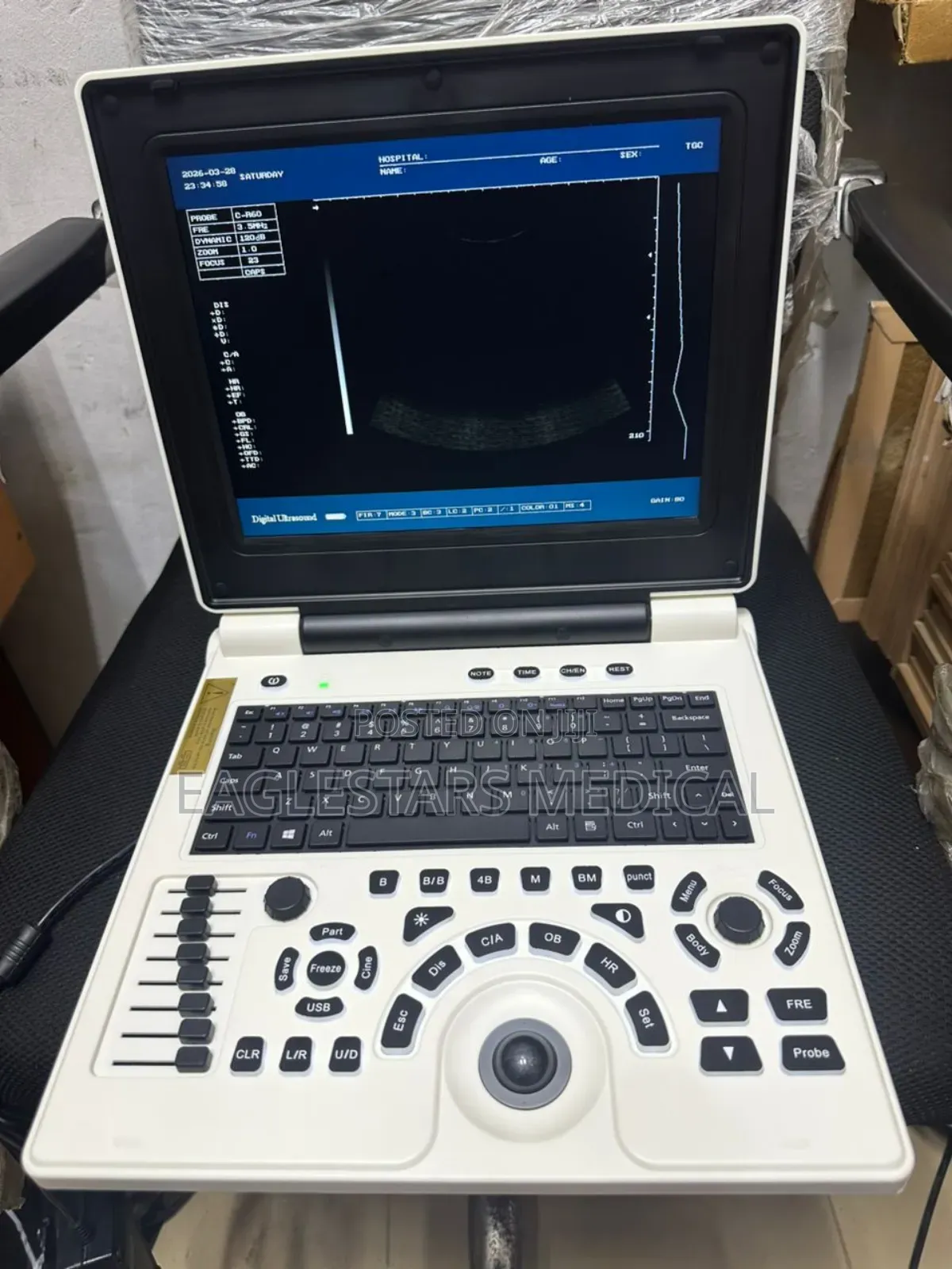 Laptop Ultrasound Scan