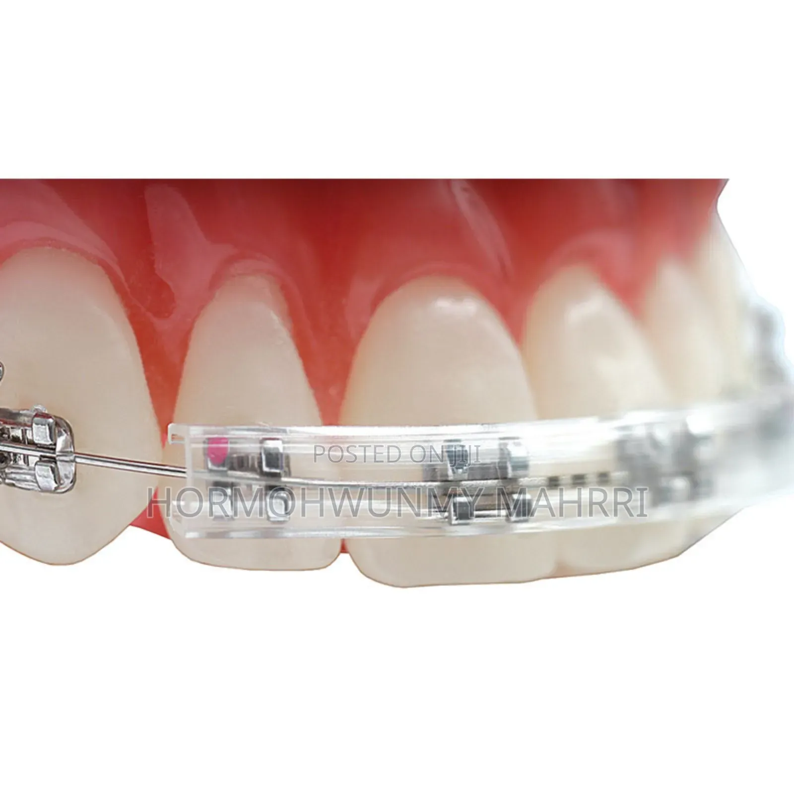 Orthodontics Wax / Orthodontic Protective Cover