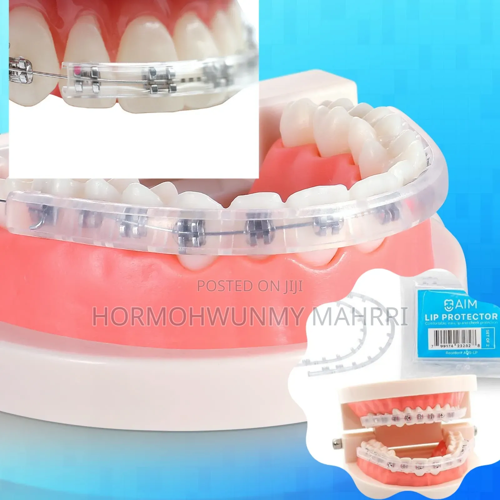 Orthodontics Wax / Orthodontic Protective Cover