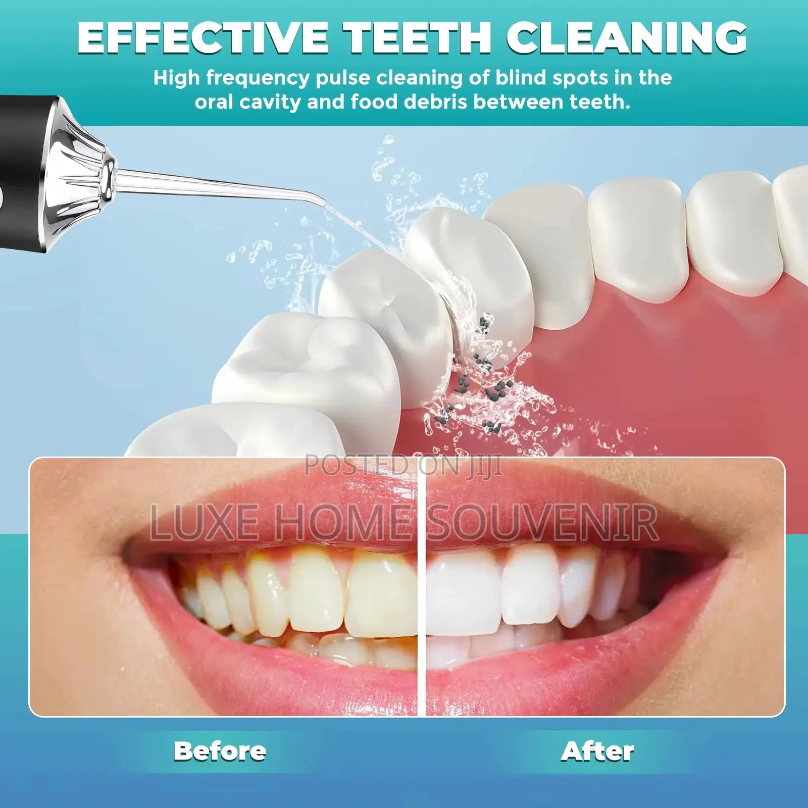 Portable Oral Mouth/ Teeth Clean Irrigator