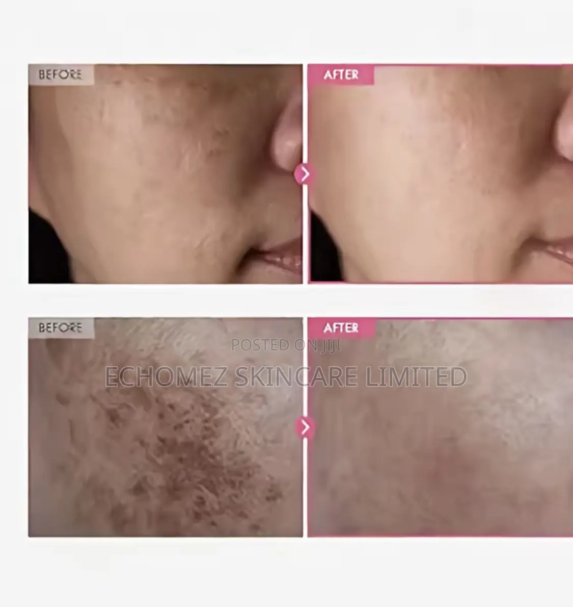 Tosowong Arbutin 7.0 +Trax 4.0 Face Cream