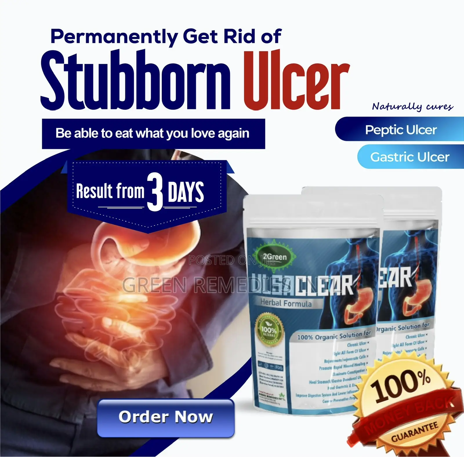 Stop Ulcer Pain From Coming Back Get U-Care Permanent Ulcer Solution