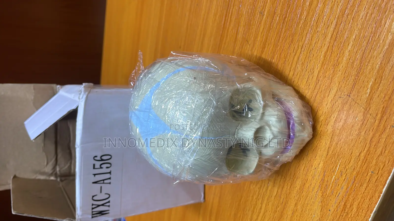 Fetal Skull Landmark