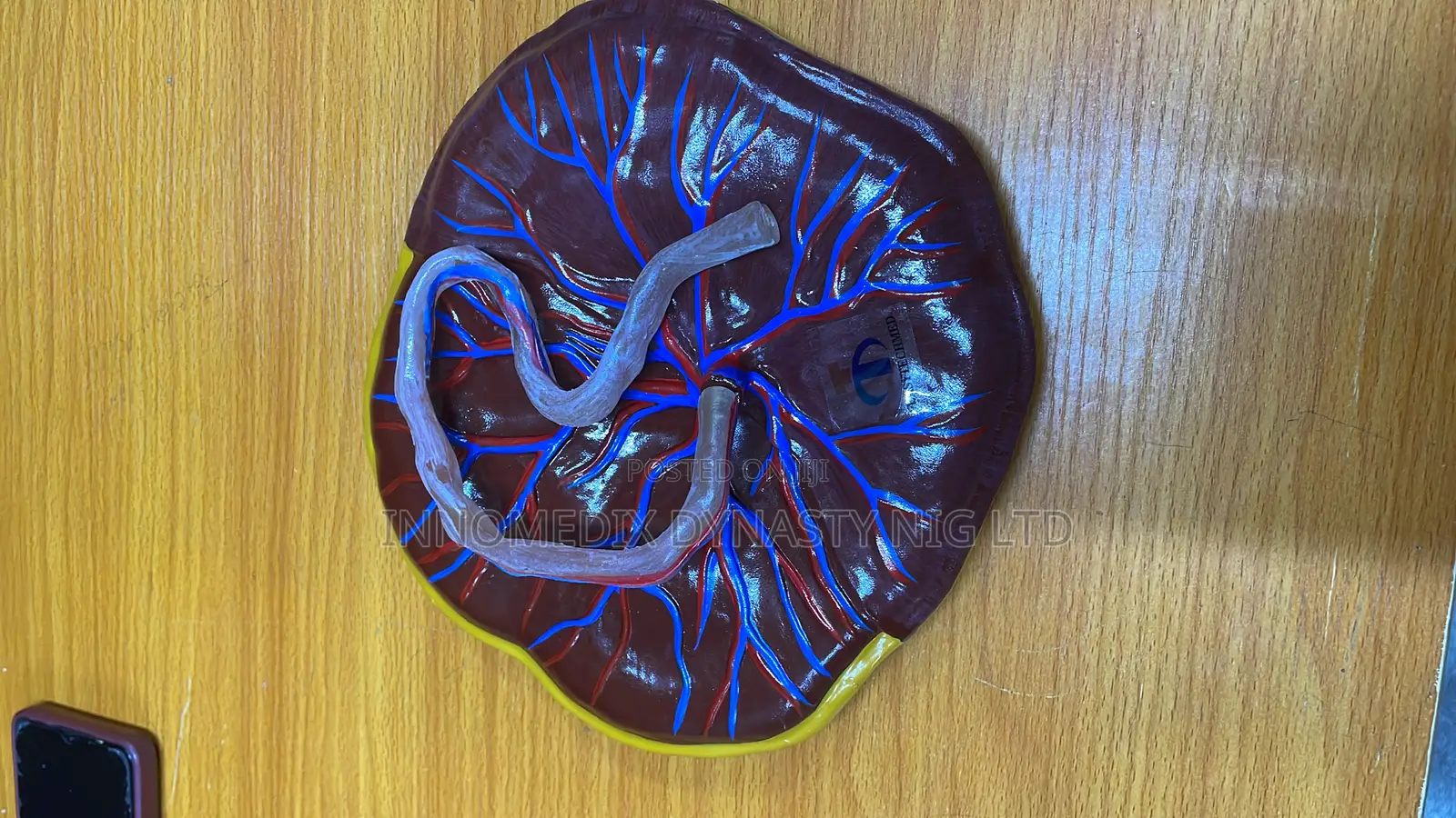 Placenta Model