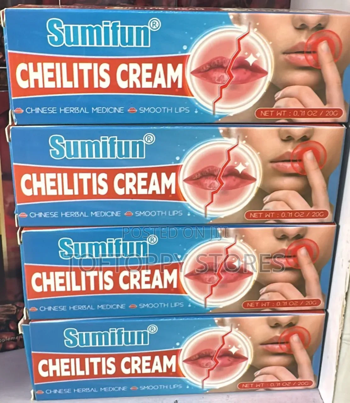 Cheilitis Herbal Lips Cream