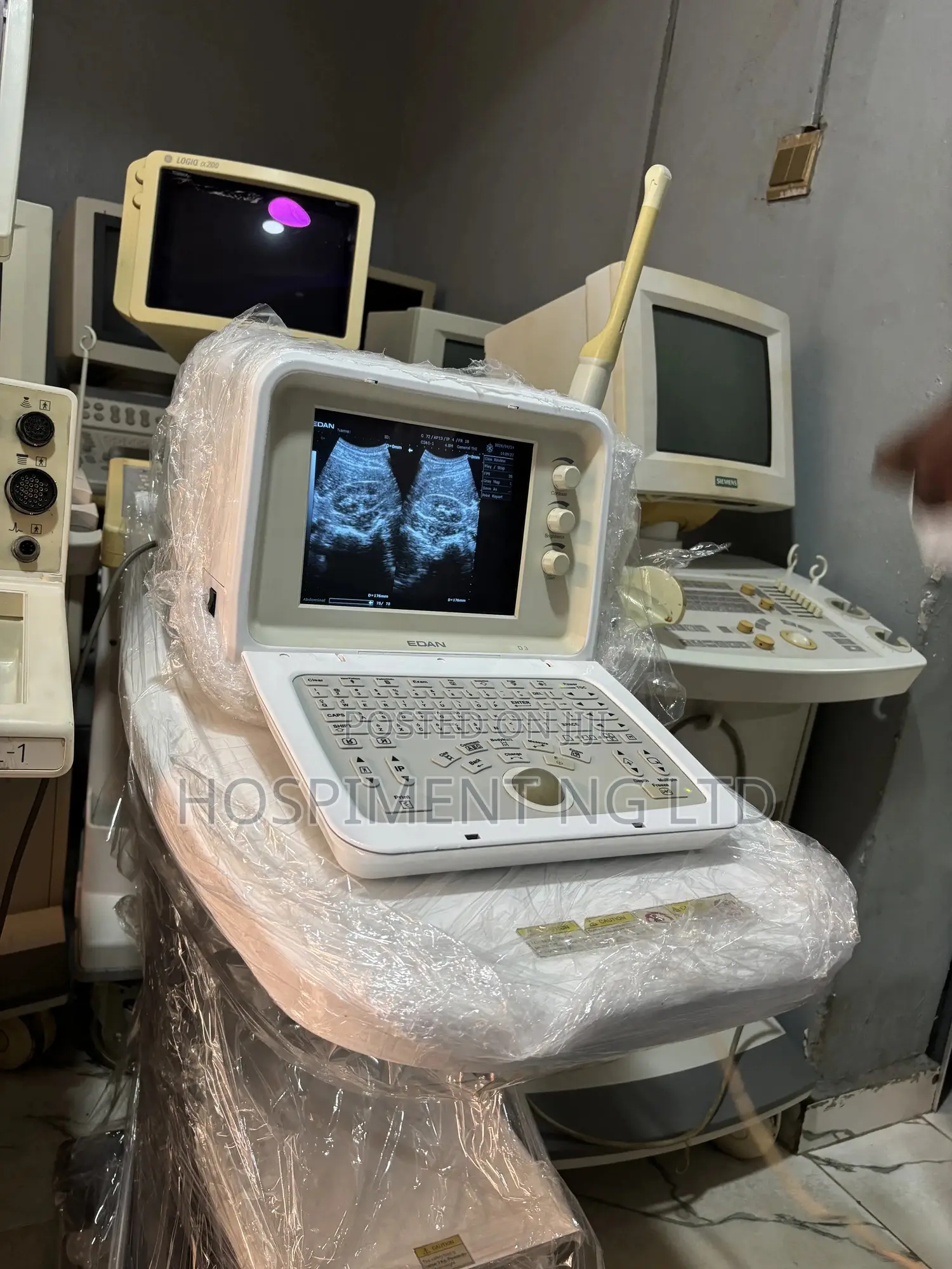 Edan D3 Tabletop Ultrasound