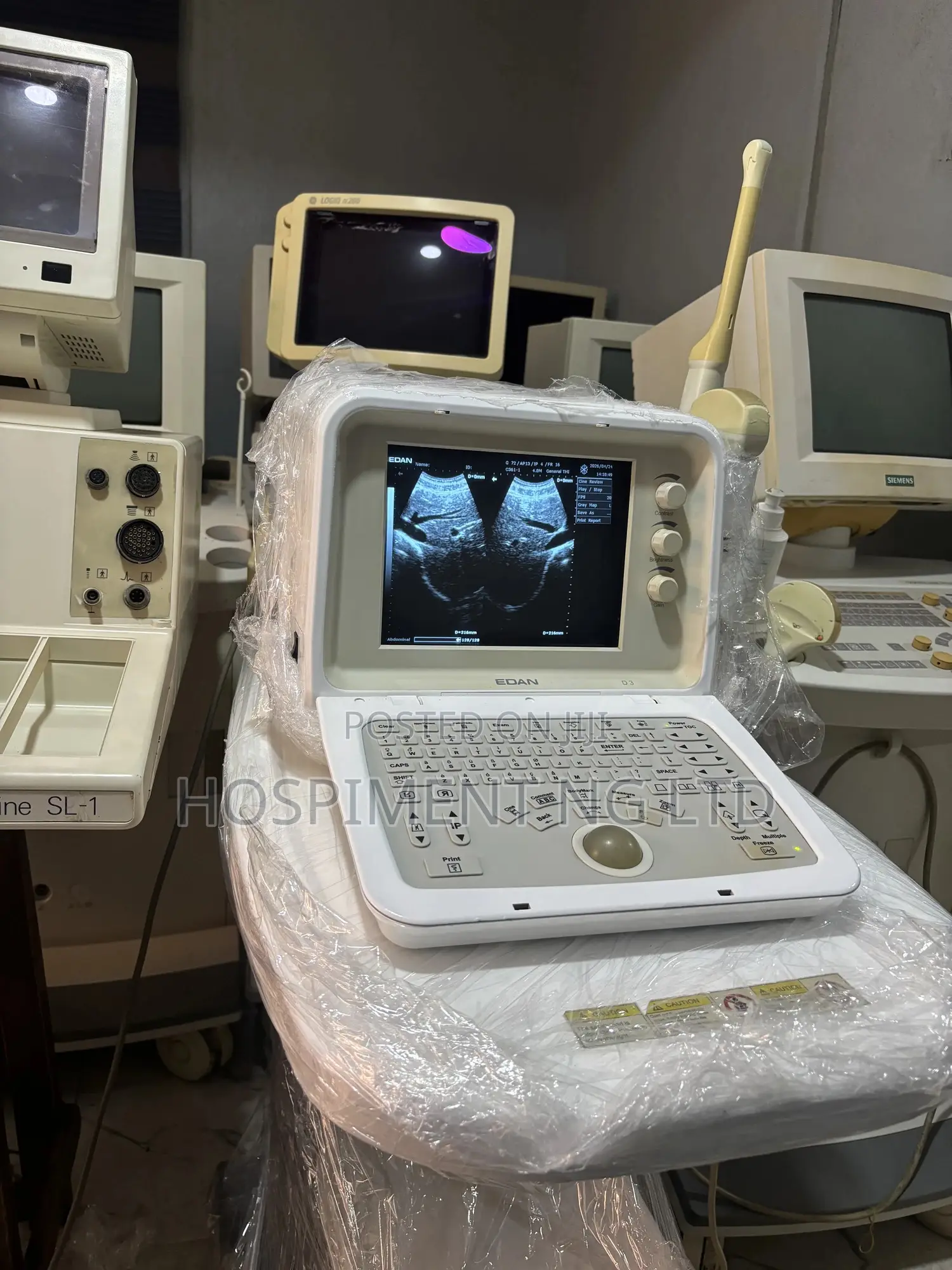 Edan D3 Tabletop Ultrasound