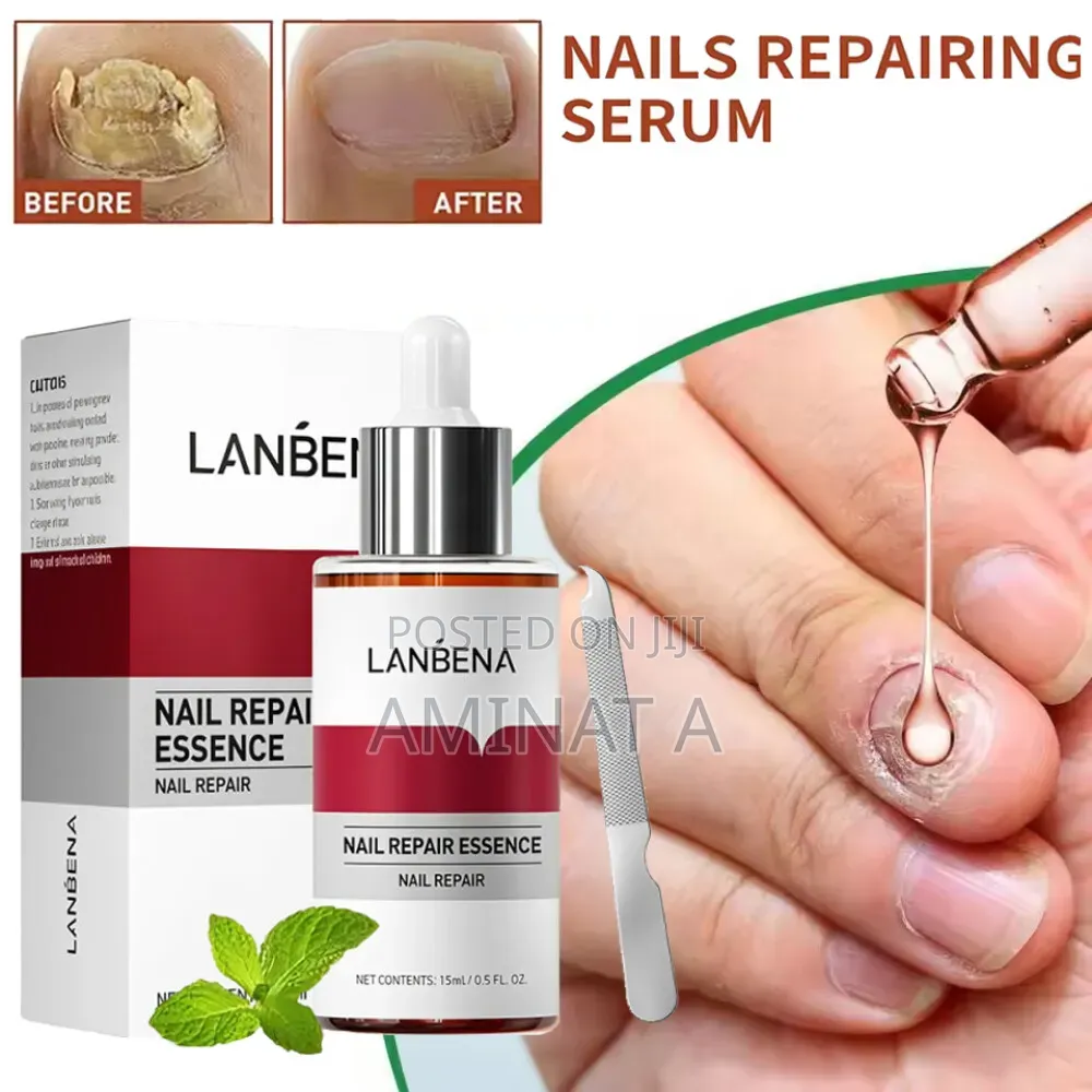 Lanbena Nail Repair Essence Serum Fungal Nail Treatment