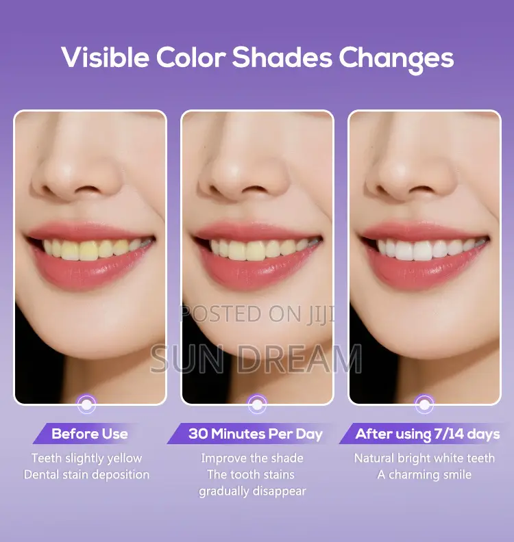 V34 Hissmile Teeth Whitening Strips 7 Pieces