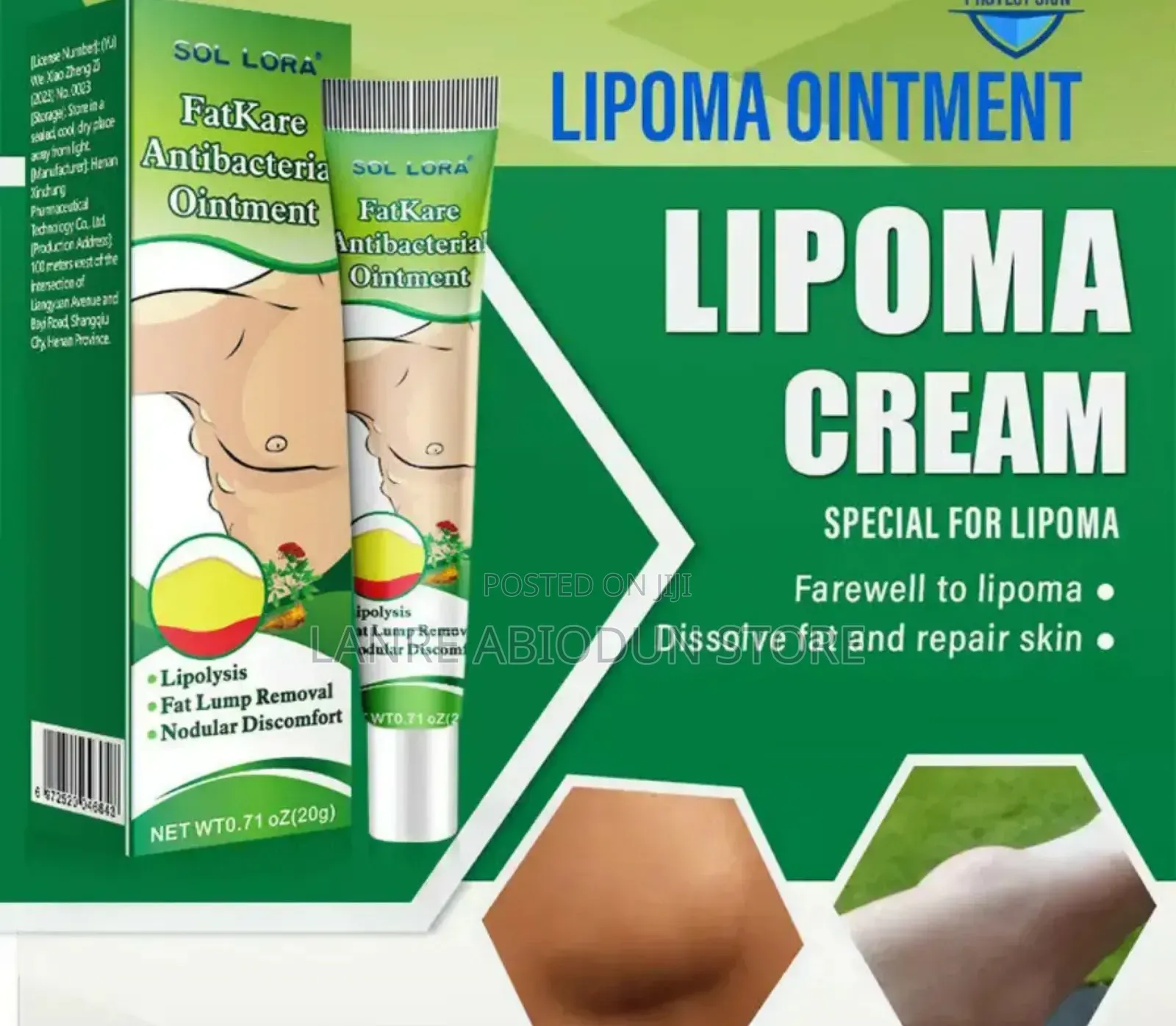 Lipoma Cream (Dissolve Fat And Repair Skin)