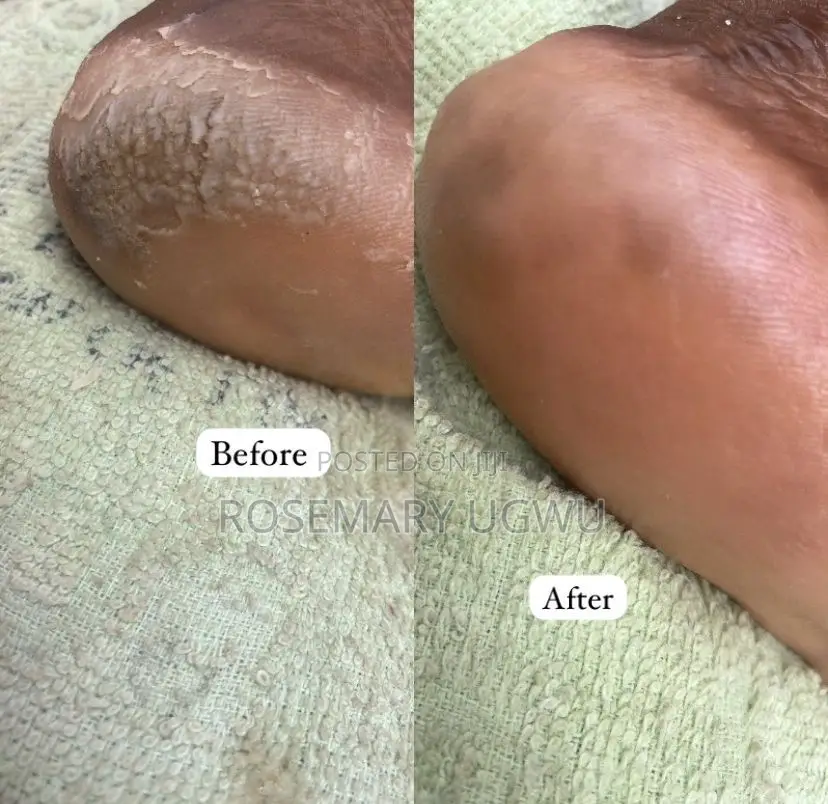 Pedicure and Manicure