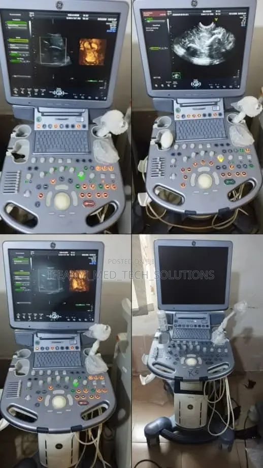 Ge Voluson S6 4d Ultrasound System