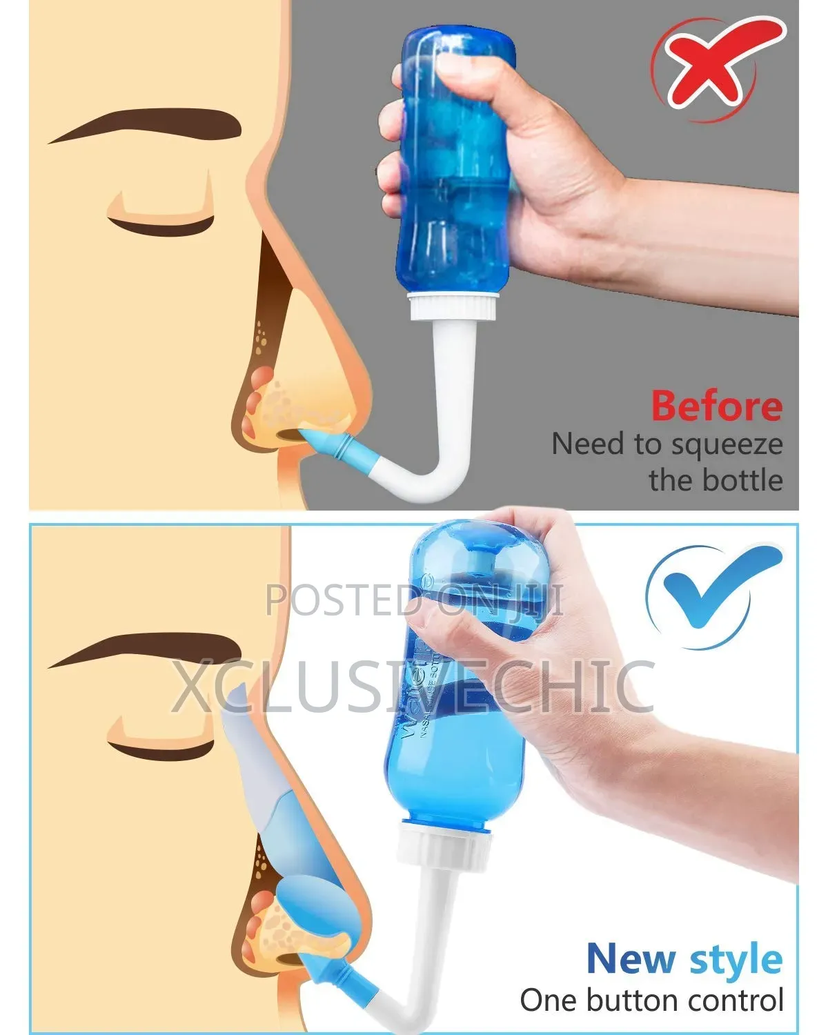 Baby Nasal Irrigator