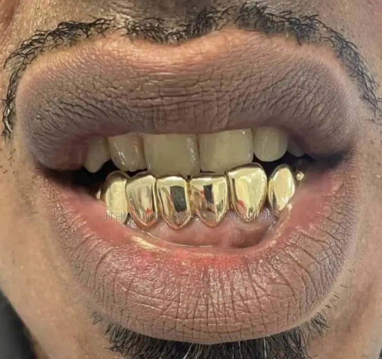 Brand New Unused 18karat Italian Gold Teeth