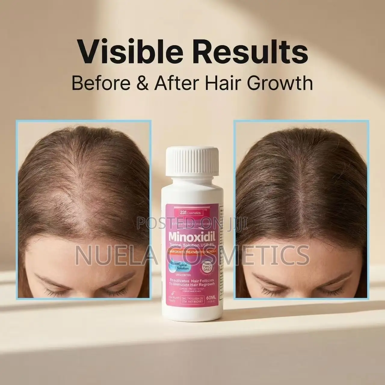 231 Cosmetics Minoxidil for Female