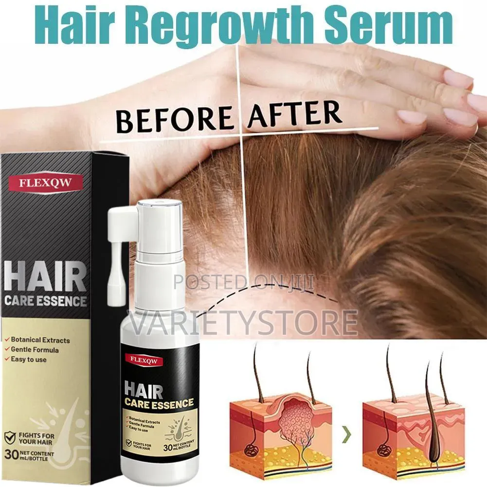 Hair Regrowth Spray