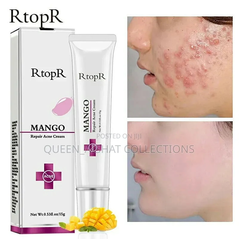 Rtopr Acne Repair Cream