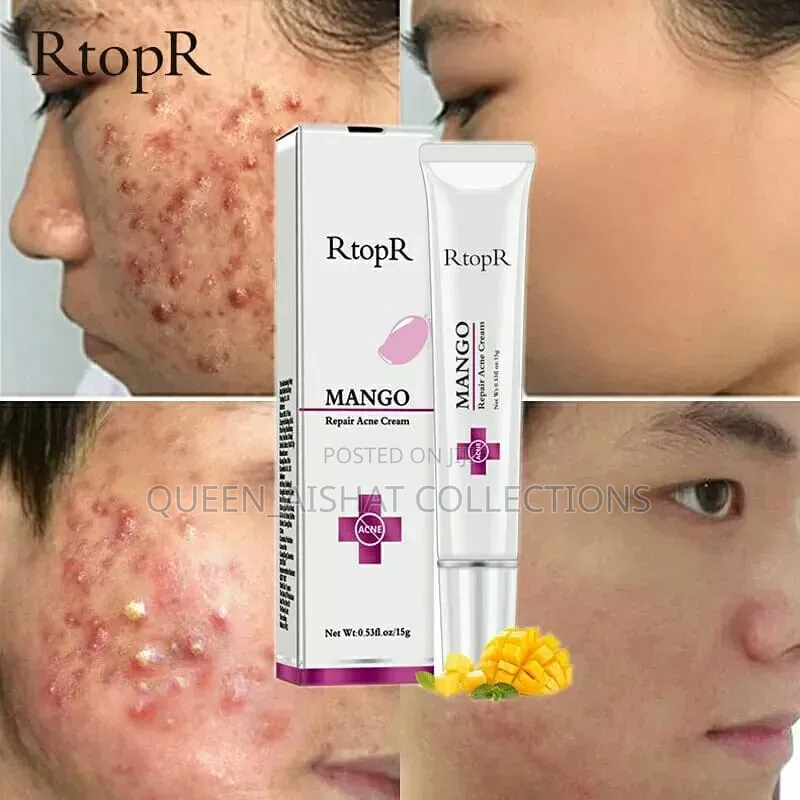 Rtopr Acne Repair Cream