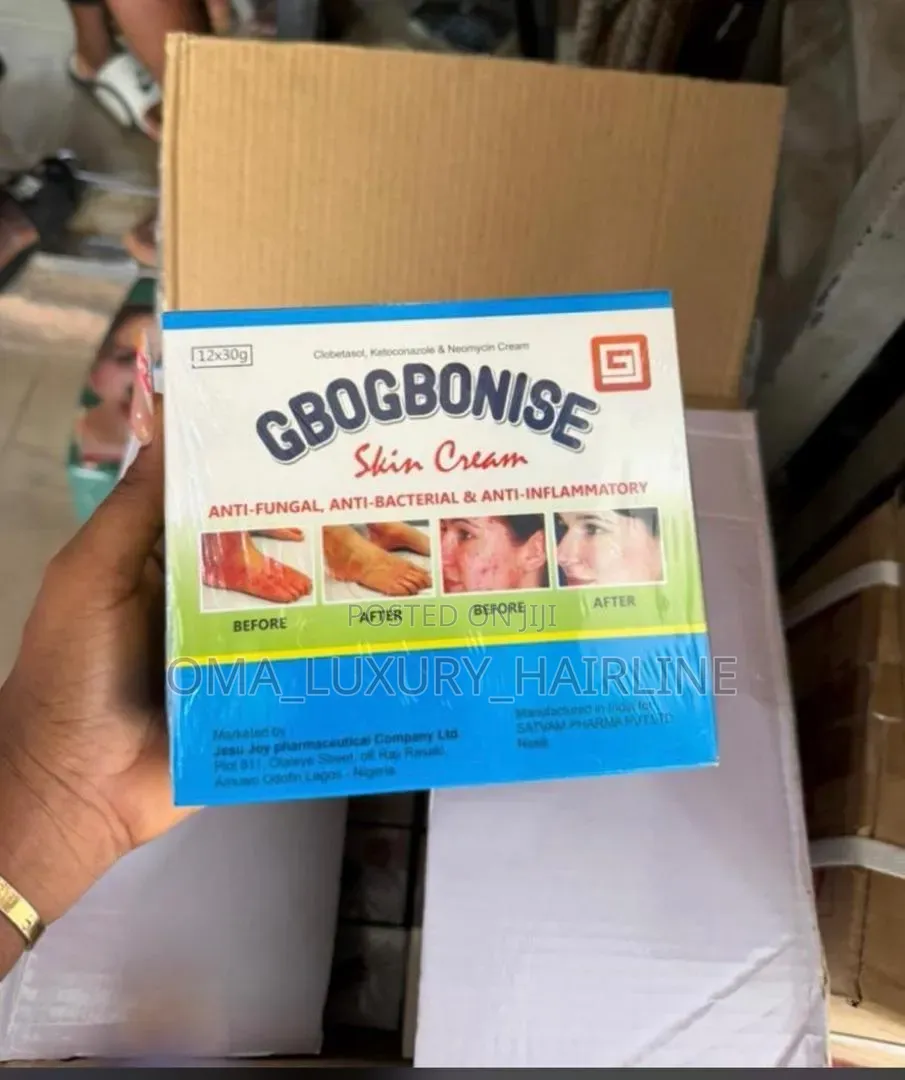 Gbognonise Tube Cream Sold in Pack