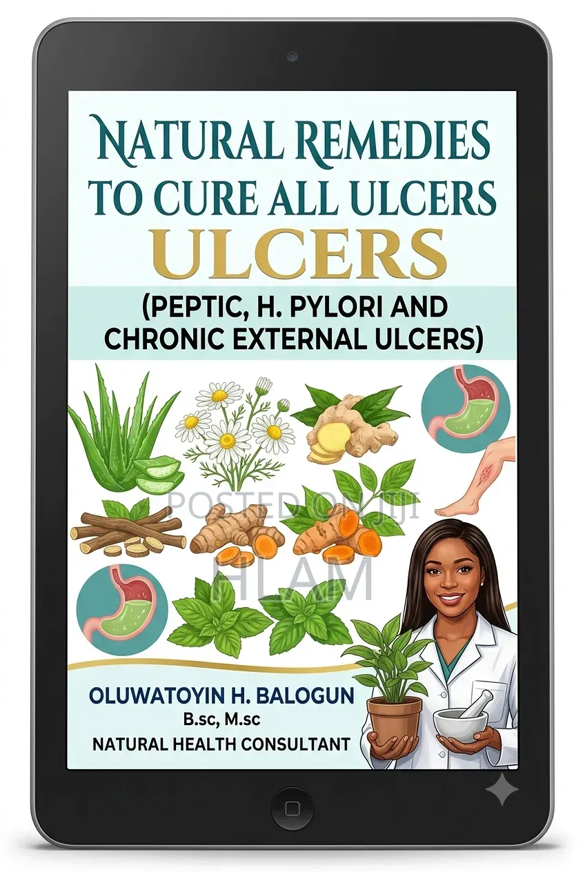 Natural Remedies to Cure All Ulcers (Peptic Chronic External Ulcers)