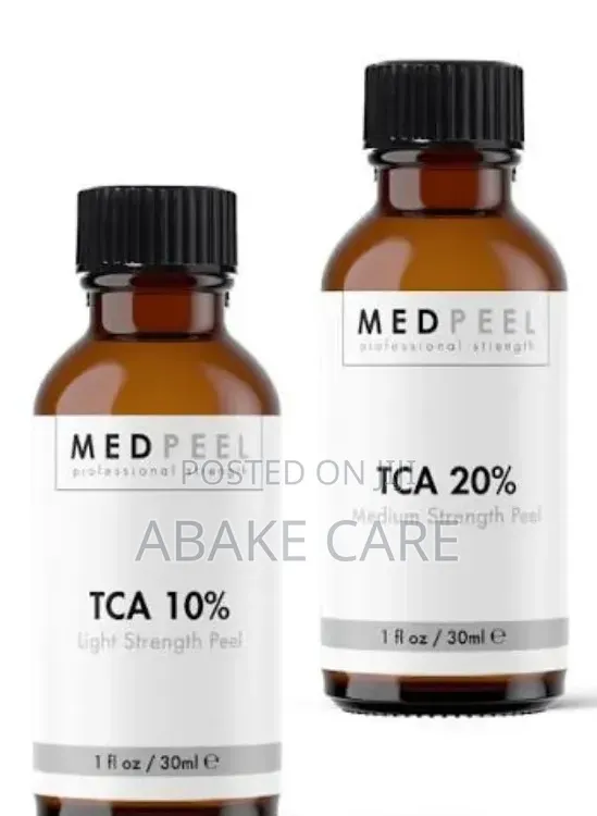 Tca Chemical Peels
