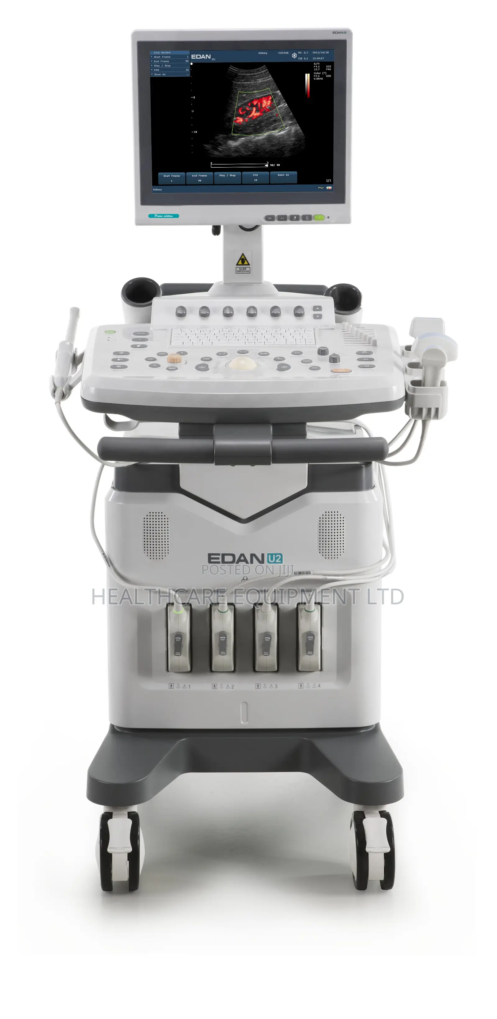 Edan U2 Color Doppler Ultrasound Machine