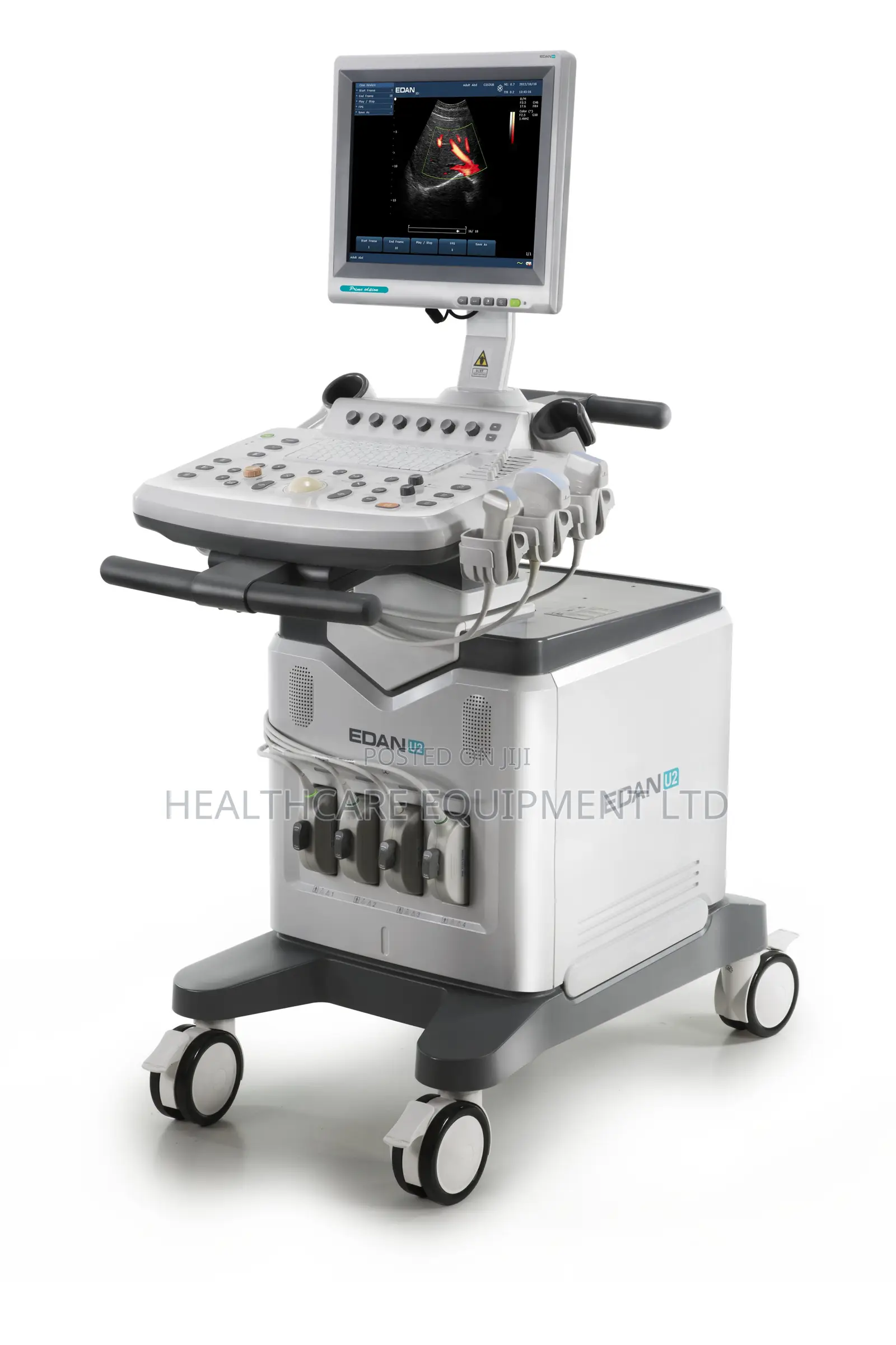 Edan U2 Color Doppler Ultrasound Machine