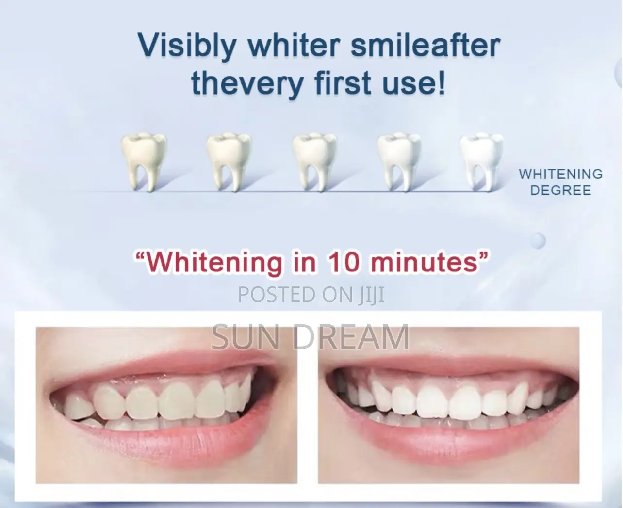 Teeth Whitening Kit Led Home Teeth Whitening Kit Very Effective