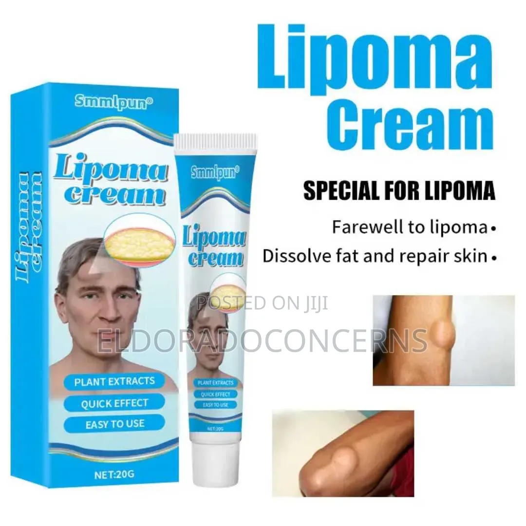 Lipoma Cream(Wholesale)