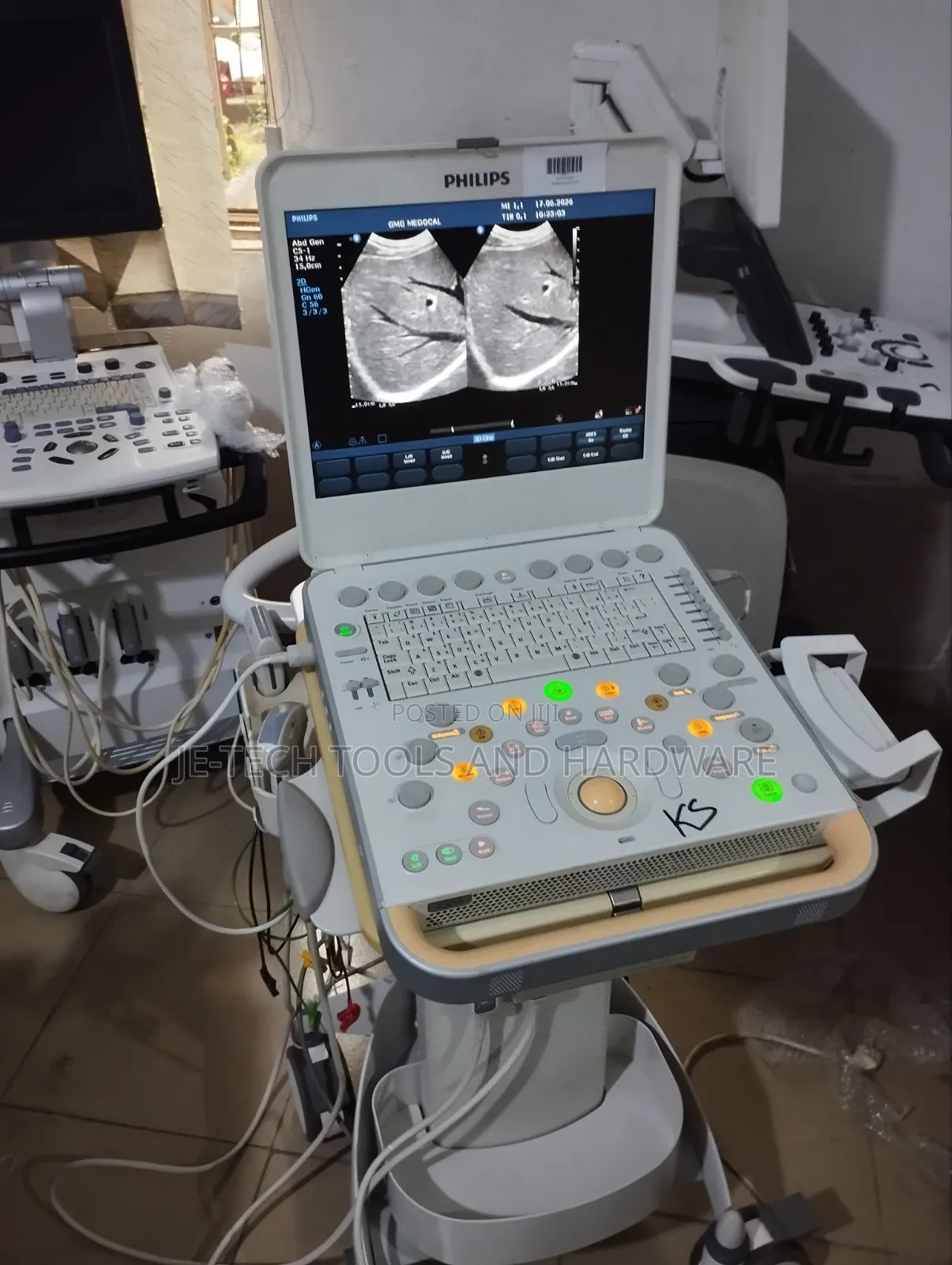 Philips Cx 50 Ultrasound Machine (Echo)