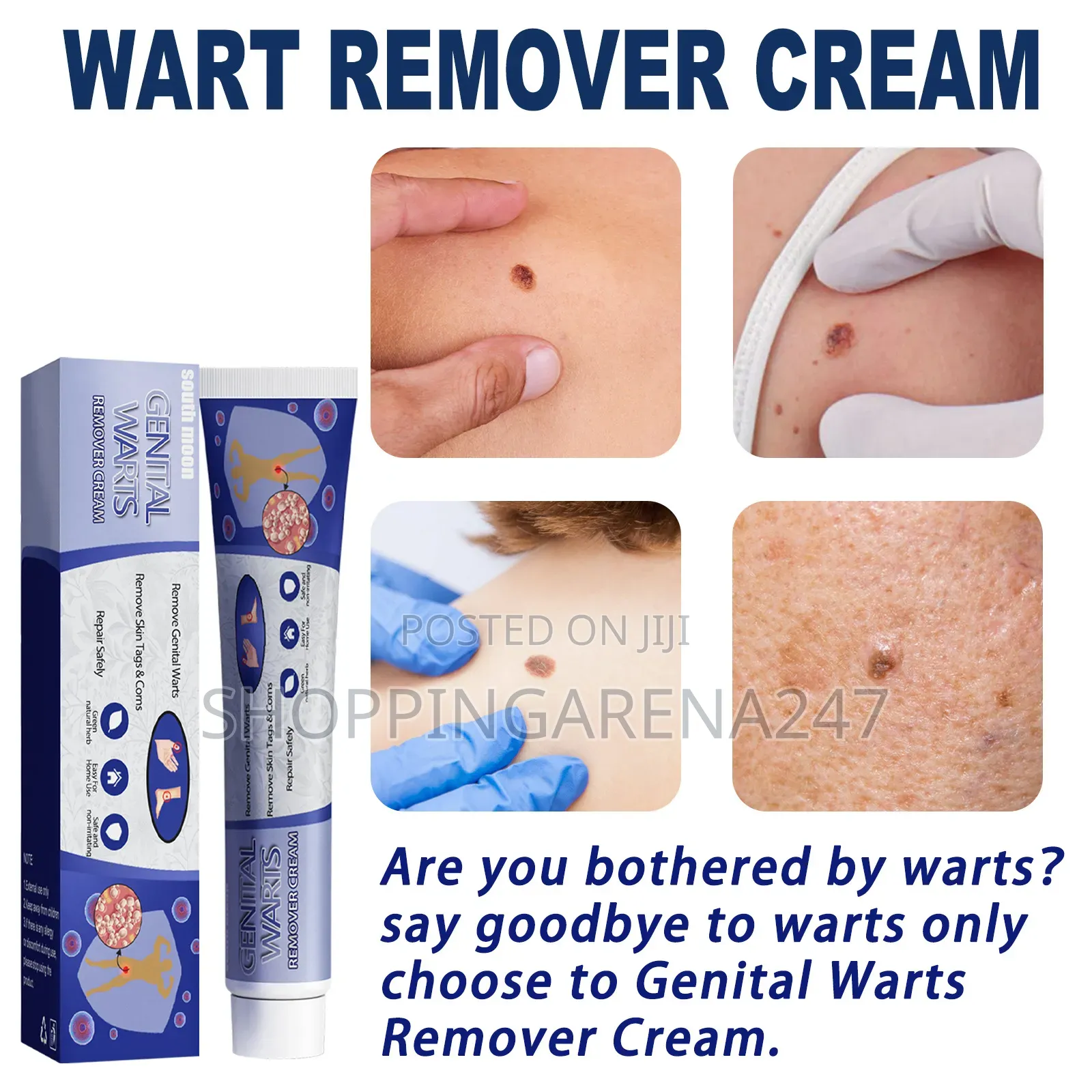 Skin Tag Common Warts Remover Ointment-20g