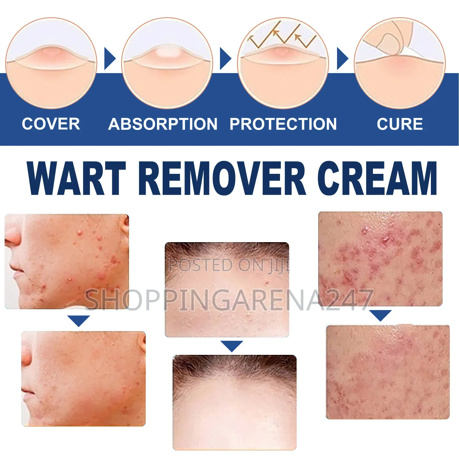 Skin Tag Common Warts Remover Ointment-20g