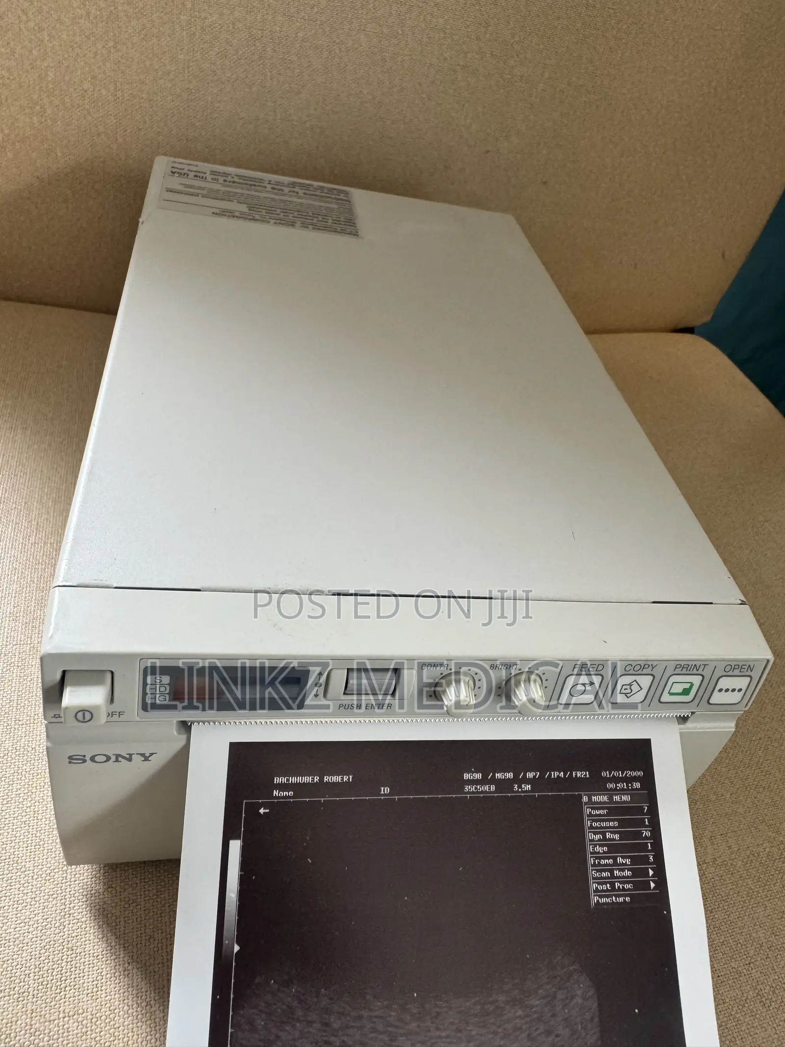 Sony Ultrasound Printers