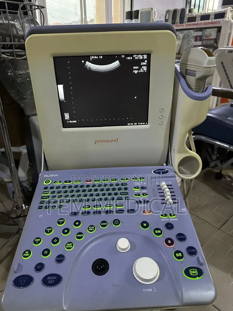 Aloka Prosound 2 Table Top Ultrasound Machine