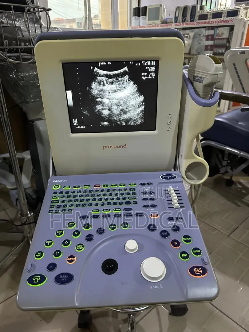 Aloka Prosound 2 Table Top Ultrasound Machine