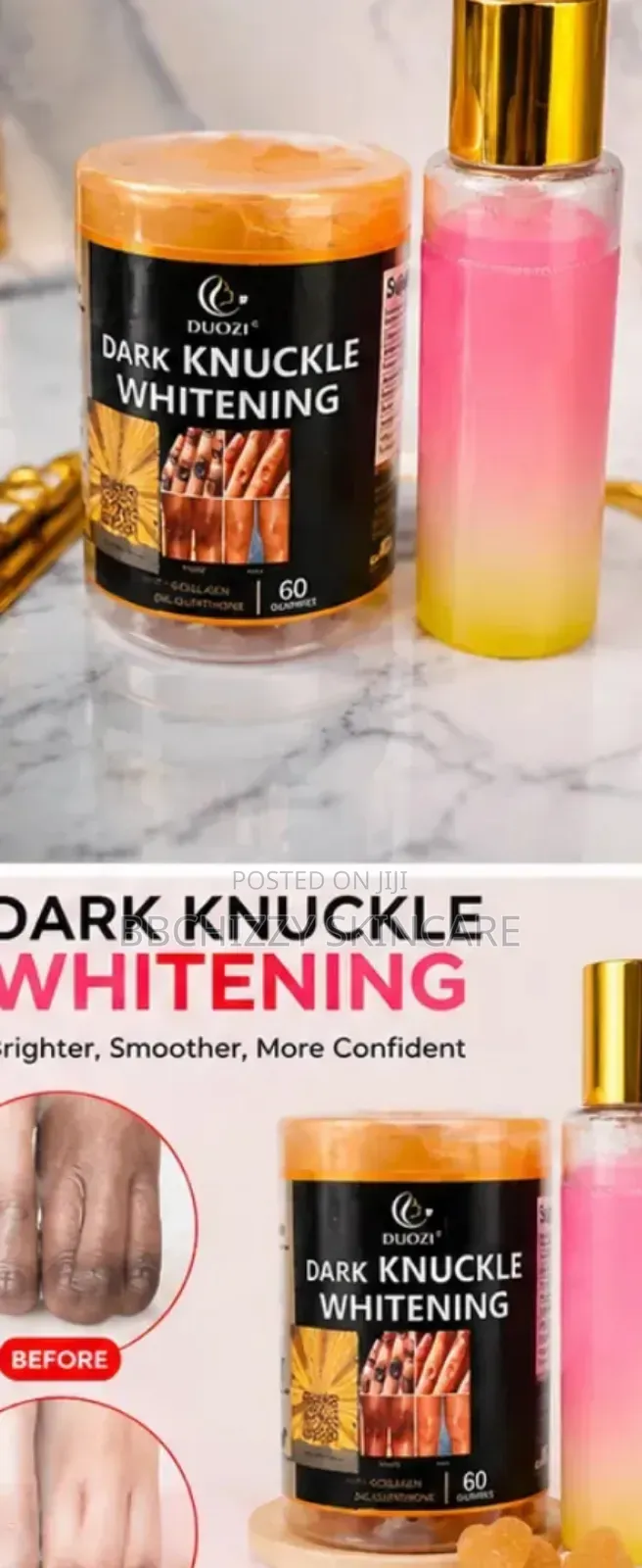 Knuckles Removal Combo
