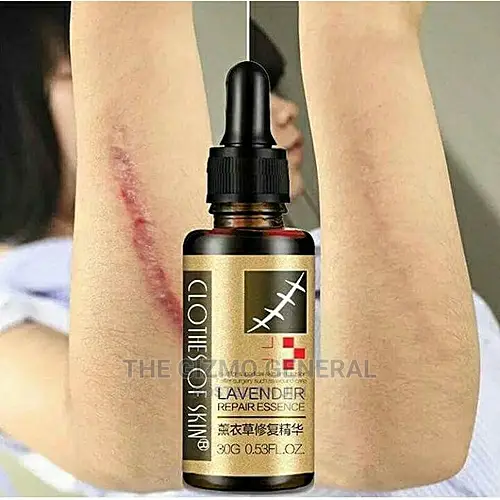 Lavender Skin Repair Essence Skin Scar Remover For All Skin Types