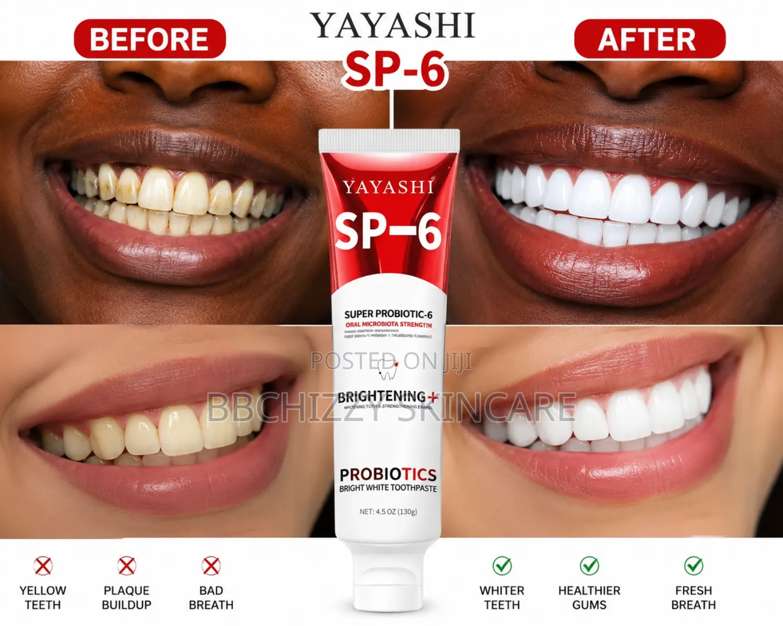 Yayashi Sp-6 Toothpaste