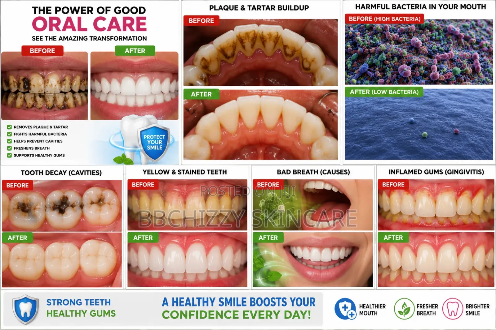 Yayashi Whitening Sp-6 Toothpaste