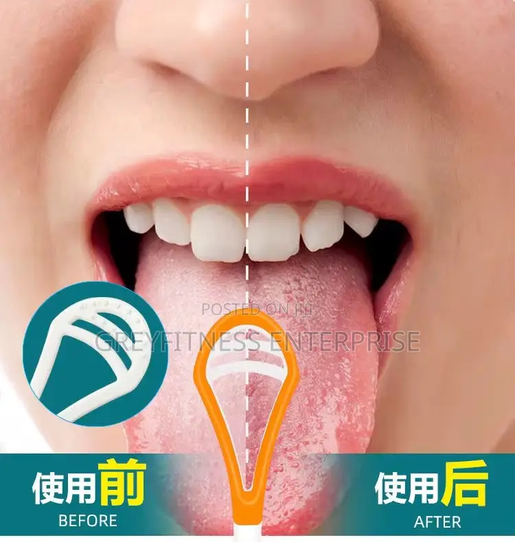 Tongue Scraper