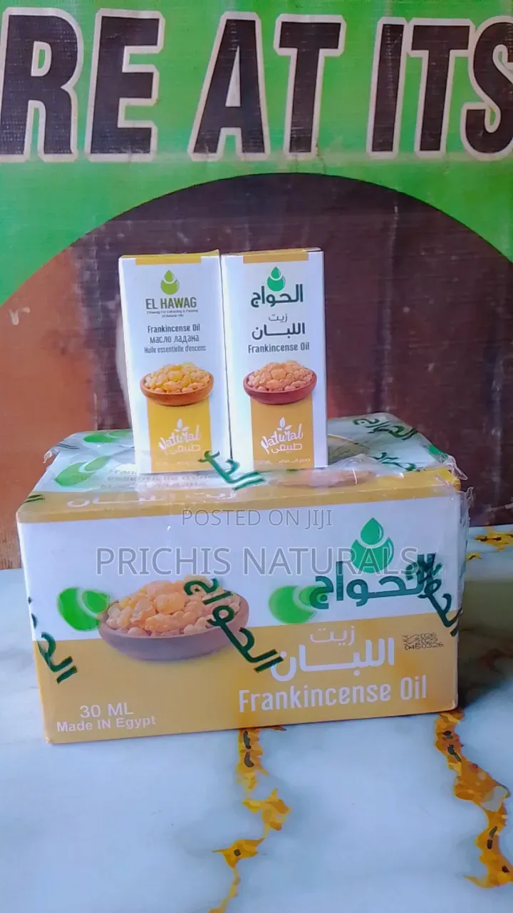 Frankincense Oil – Pure Frankincense Oil for Aromatherapy, Skincare